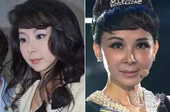 可惜！她們在整形上癮前都曾美過 明星整容