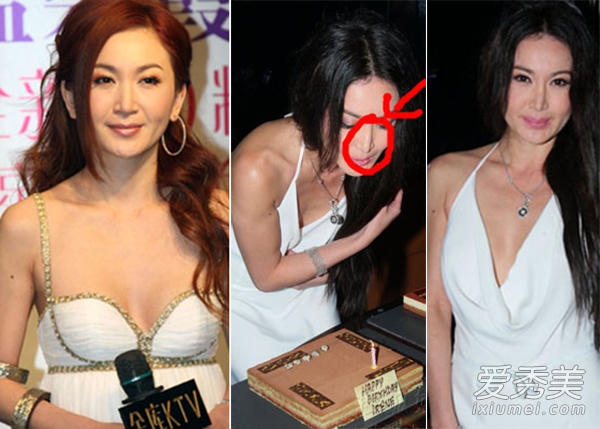 杨子姗霍建华小S萧蔷 鼻子歪天生or整容？