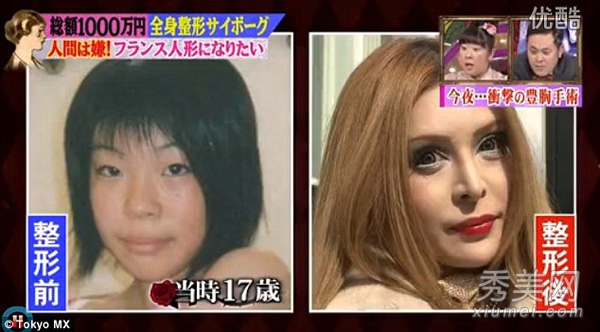 日本少女整容变“芭比” 63万30次整容（图）