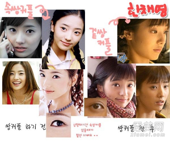 韩国娱乐圈丑女大翻身 看谁整容最成功？