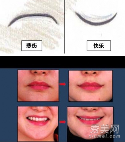 韩国整容新宠“微笑唇”嘴角上扬整形手术