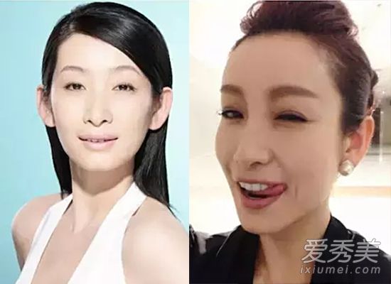 秦海璐为单眼皮投保百万 为啥又要割双眼皮呢？ 秦海璐割双眼皮