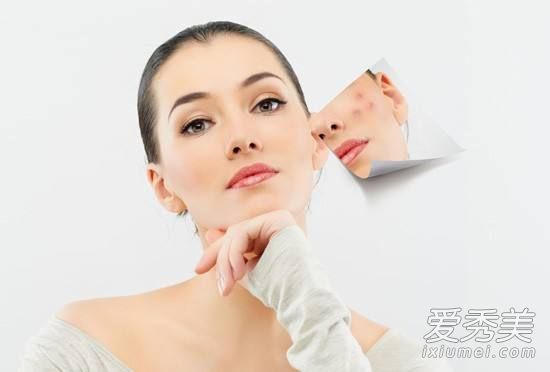 那个来狂冒痘?女生必学生理周期肌肤保养法 痘痘怎么快速消除