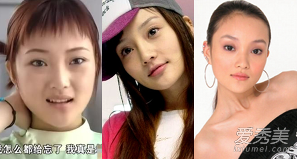 不整容不是好演员！柳岩张天爱容貌变化惊人 女明星整容前后