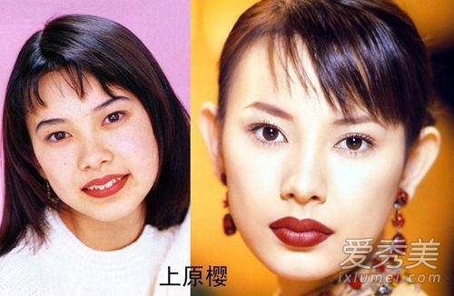 日本明星整容更疯狂 人造假脸美丑两极化