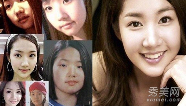 整容案例：3大韩国女明星整容最成功