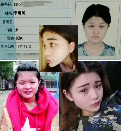 《变形计》韩安冉李幼恩 不良少女整形变网红 《变形计》整容女