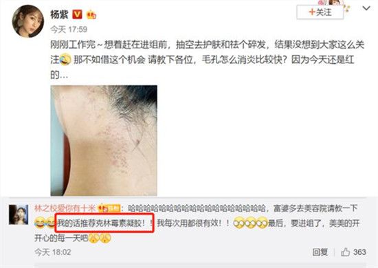 克林霉素凝胶的功效是什么?