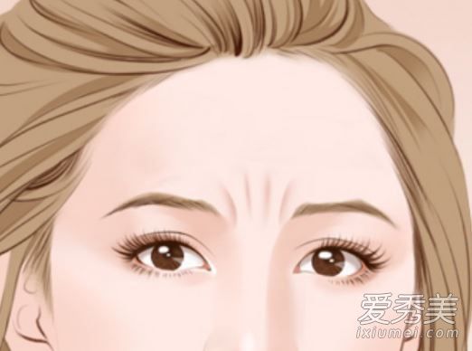 眉毛皱纹怎么去除？这些动作有助于减少皱纹。