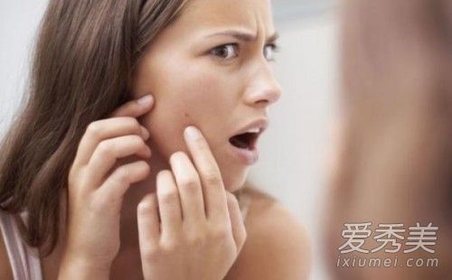 SDD美容護膚公司成立“痘警告者”夏季聯盟，讓痘“永遠消失”