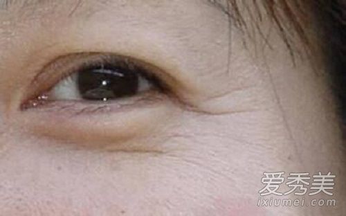 哪種眼霜對眼睛皺紋有好處？足以讓人流淚的抗皺眼霜。