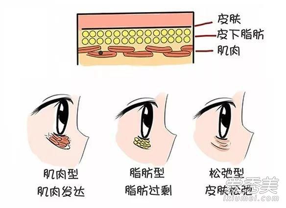 眼袋如何去除最好？防止眼睛周围皮肤老化的方法
