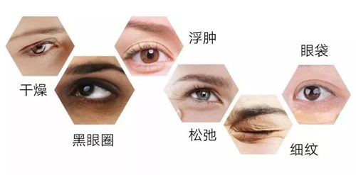 邁錫爾用於評價眼霜的效果:消除黑眼圈、幹燥皺紋和減輕腫脹。