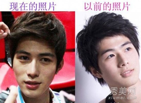 男明星整容前后，刘阿龙成为“整容脸”