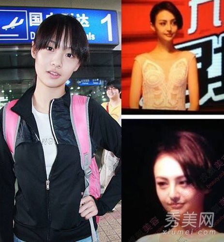 這位女演員的臉平淡而痛苦。劉曉慶和鄭爽被整形手術打敗了。