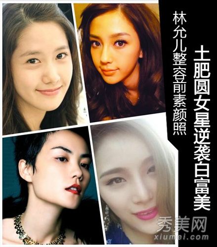 林允娥整容的老照片暴露了女演員整容的成敗？