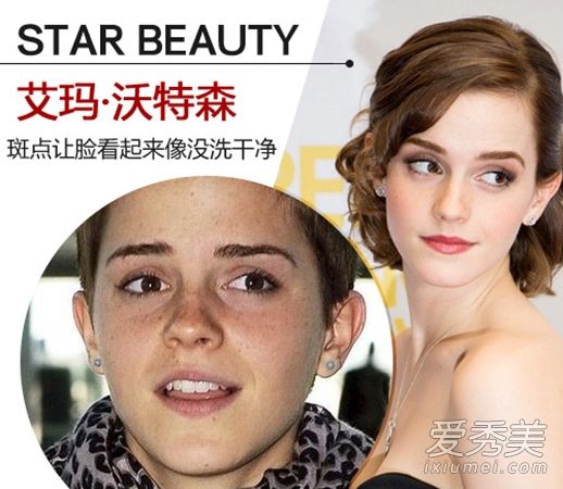 欧美女演员脸上有雀斑，不能化妆。
