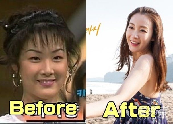 韩国女演员在整容前暴露崔智友眼睛和鼻子塌陷的老照片