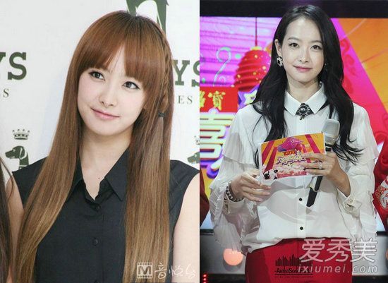 发际线后退的暴露年龄?你可以试试这些方法