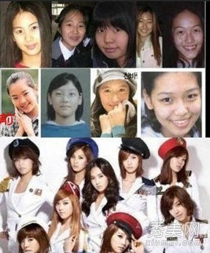 哪个韩星在少女时代整形手术失败了,李多海,蔡琳?(2)