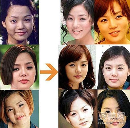 李多海,蔡琳,郑丽媛,韩国第一位女性整形外科医生有后遗症