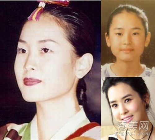 哪个韩星在少女时代整形手术失败了,李多海,蔡琳?(1)