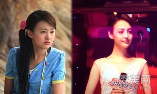在分手和整形手术前后,和汉斯·张比较了美丑。