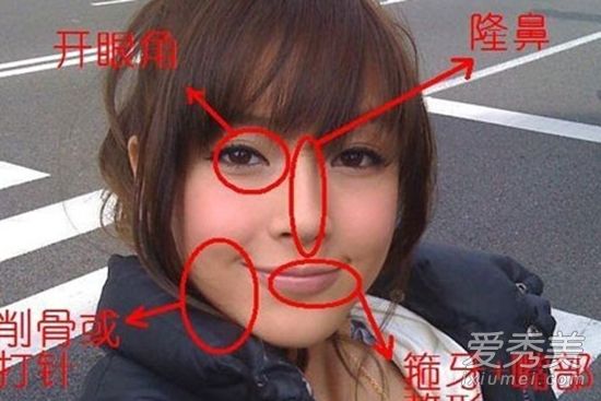 杨颖的整容手术让假肢因美丽而遭到排斥?