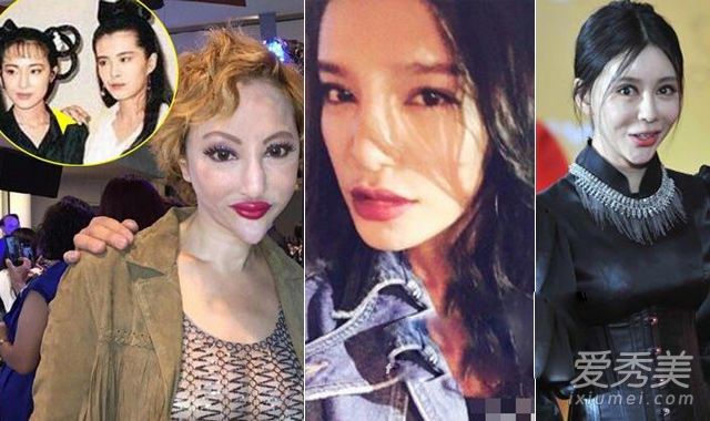 女明星整容照片:江映蓉经常变脸的薛芷伦太吓人了
