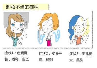 局部卸妆VS全面的毛孔清洁是最重要的。