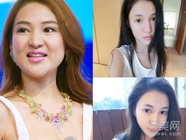郭美美的整形脸变得僵硬，透露出整容明星的眼泪
