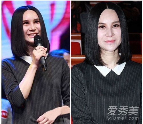 整形手术对尚雯婕面部变形女演员爆发的后遗症