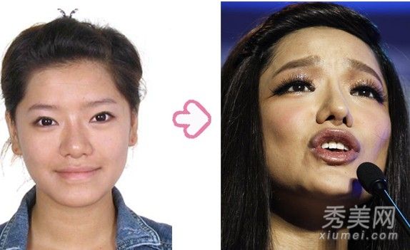 后天在尚雯婕，何洁。超级女性整形外科女演员名录