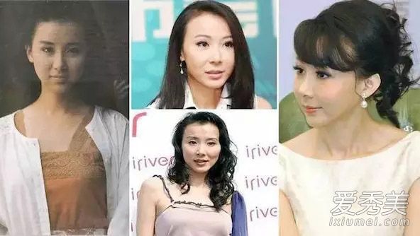 发际线向后移动会影响面部表情。我应该怎么打理头发?