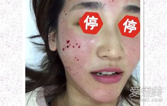 擦完指甲油后你能化妆多长时间?上光后多久可以使用护肤品?