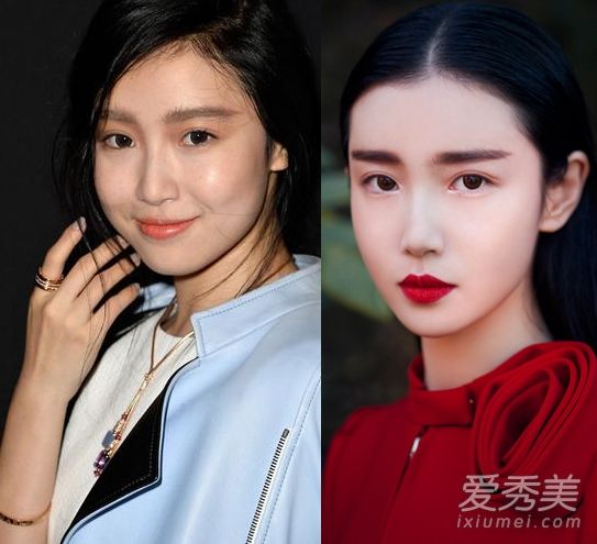 张辛苑又一次“变了脸”,他的脸又肿又紧,难以辨认。