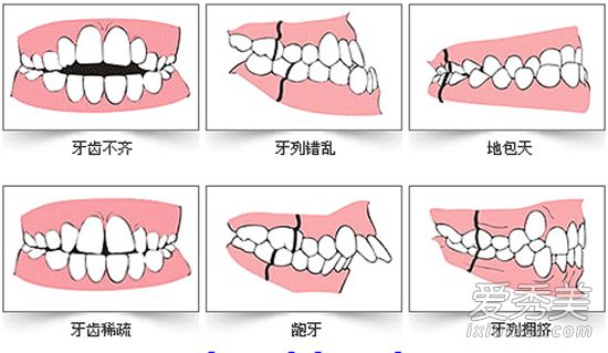 为什么杨蜜宝宝是唯一一个在13颗星星被修剪牙齿前后变得美丽的人?