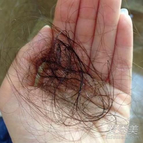 白发还是脱发?夏天多吃6种食物对你的头发有好处。