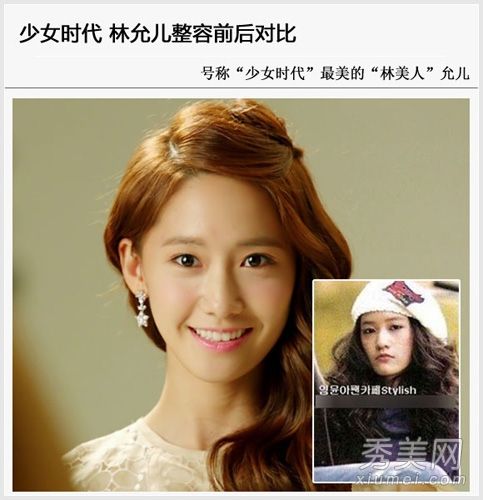 韩国第一女子联盟七名成员的整形手术细节