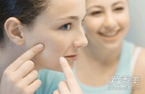 如何处理危险三角区的痤疮