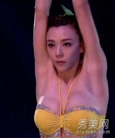 周韦彤隆胸和整形手术