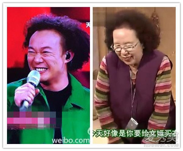 当发际线向上移动时,你看不见人吗?这样做可以减轻每天的脱发