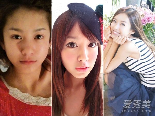 张承认旧整容照片的外观发生了很大变化