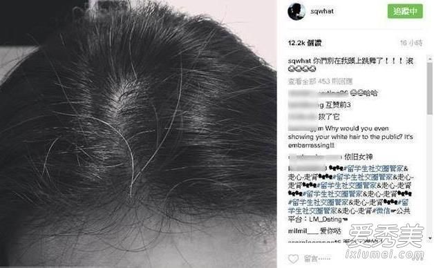 我怎样才能防止我的头发变白?预防白发的方法和对策