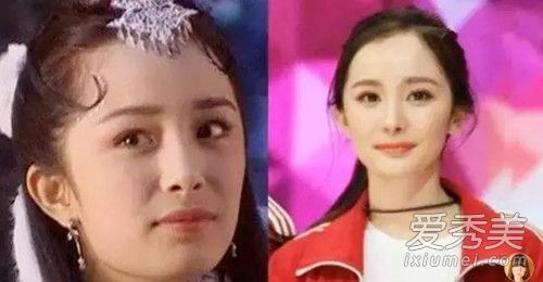 娱乐圈的哪些明星改变了发际线?改变发际线会有什么影响?