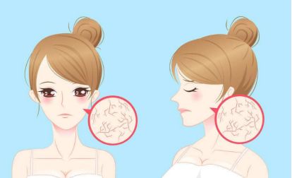 眼部细纹如何去除眼角不长皱纹的好方法