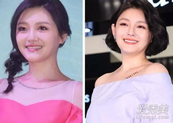 明星的波波救了很多人。有适合你的吗?