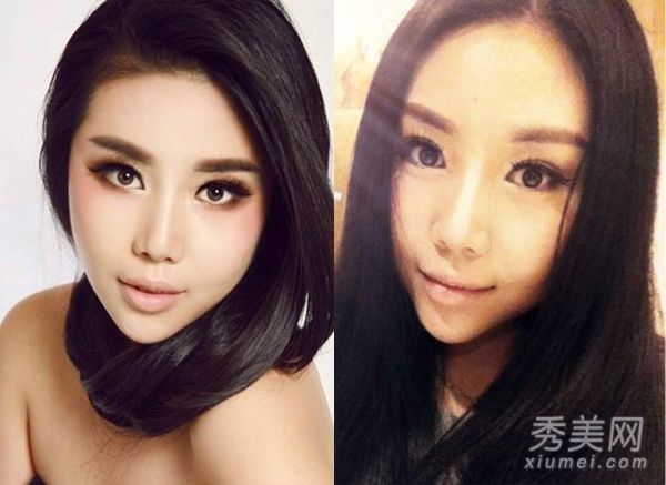 整形外科的四大疑点:下巴+统治模式+睁眼纪敏佳