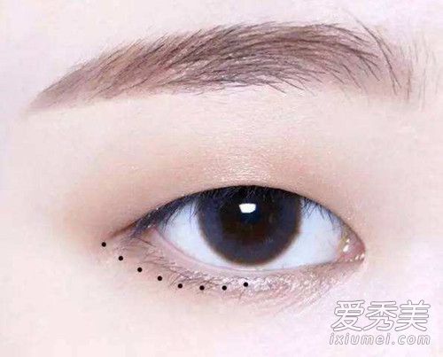 单眼皮能打开眼角吗?单眼皮可以纹上虹膜线吗