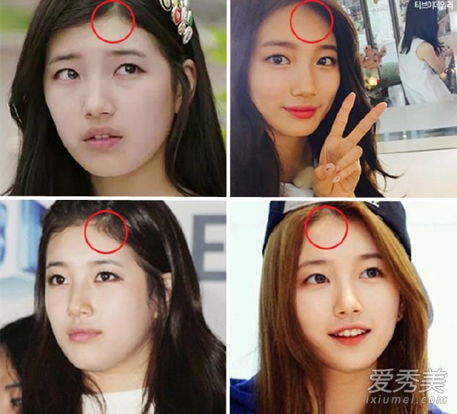 如何拯救不完美的发际线?学习女神2向黑人历史告别的步骤